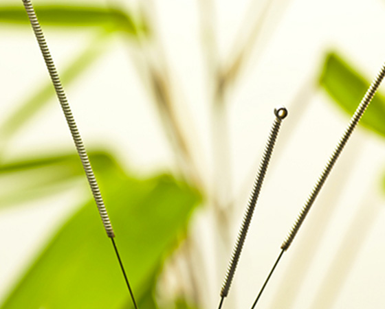 acupuncture-medecine-complementaire.jpg